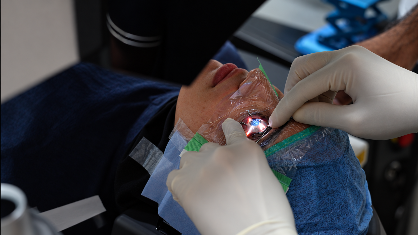 Glasses Removal Surgery in Pakistan